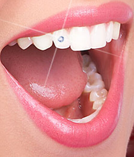 tooth-jewellery